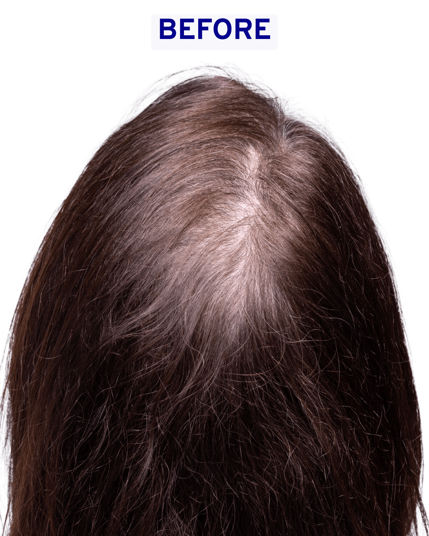Hair & Scalp Serum | Hydration & Shine Captain Blankenship