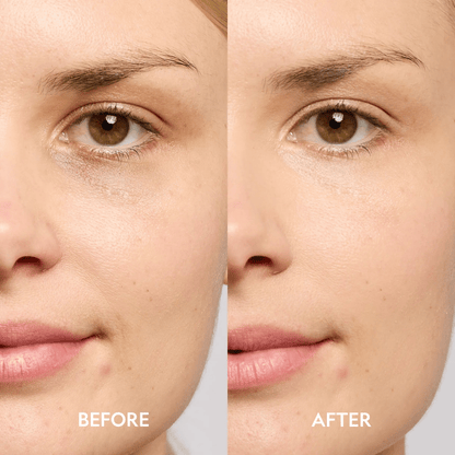 Super Bright Dark Circle Serum Peptide Corrector - Get it from Bo