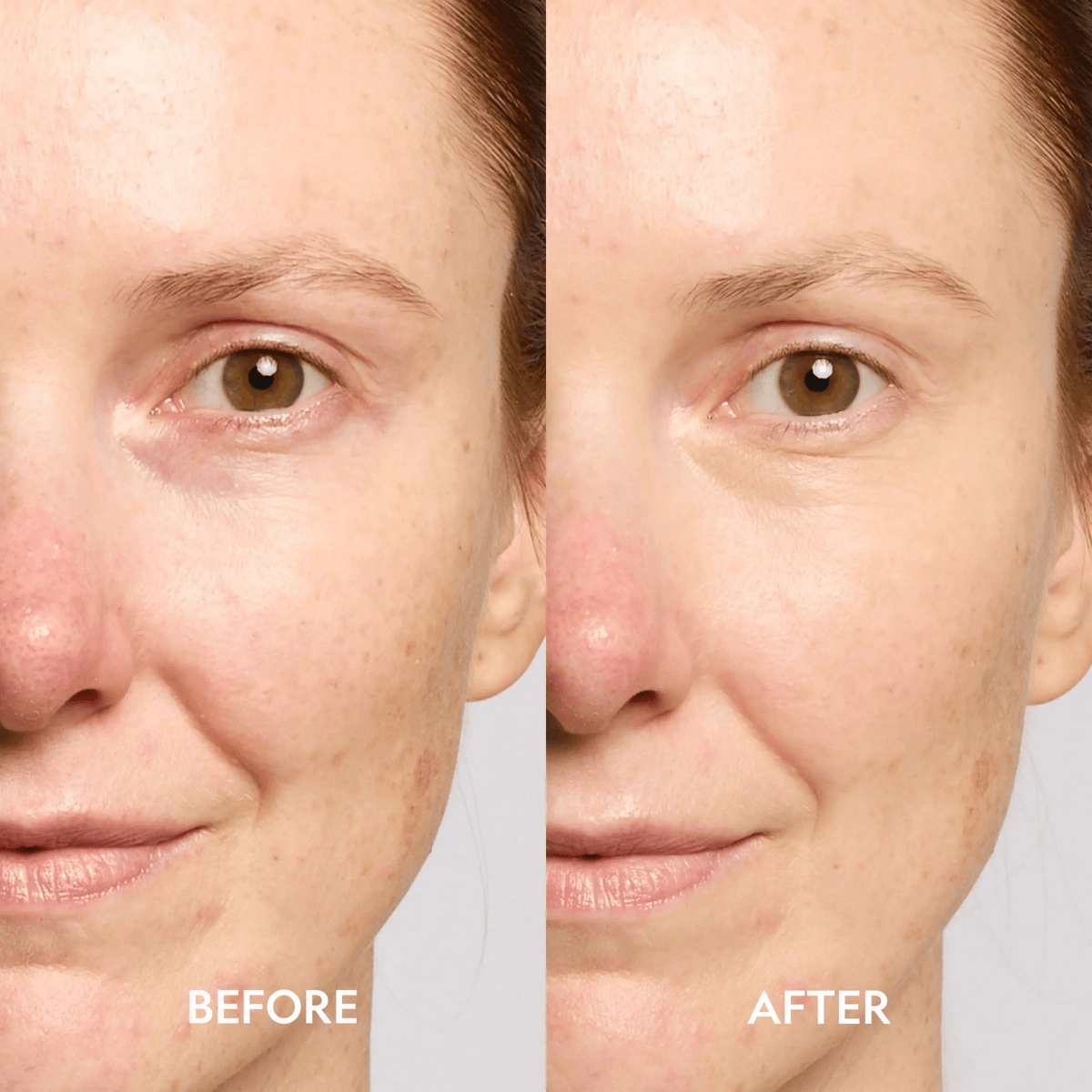 Super Bright Dark Circle Serum Peptide Corrector - Get it from Bo